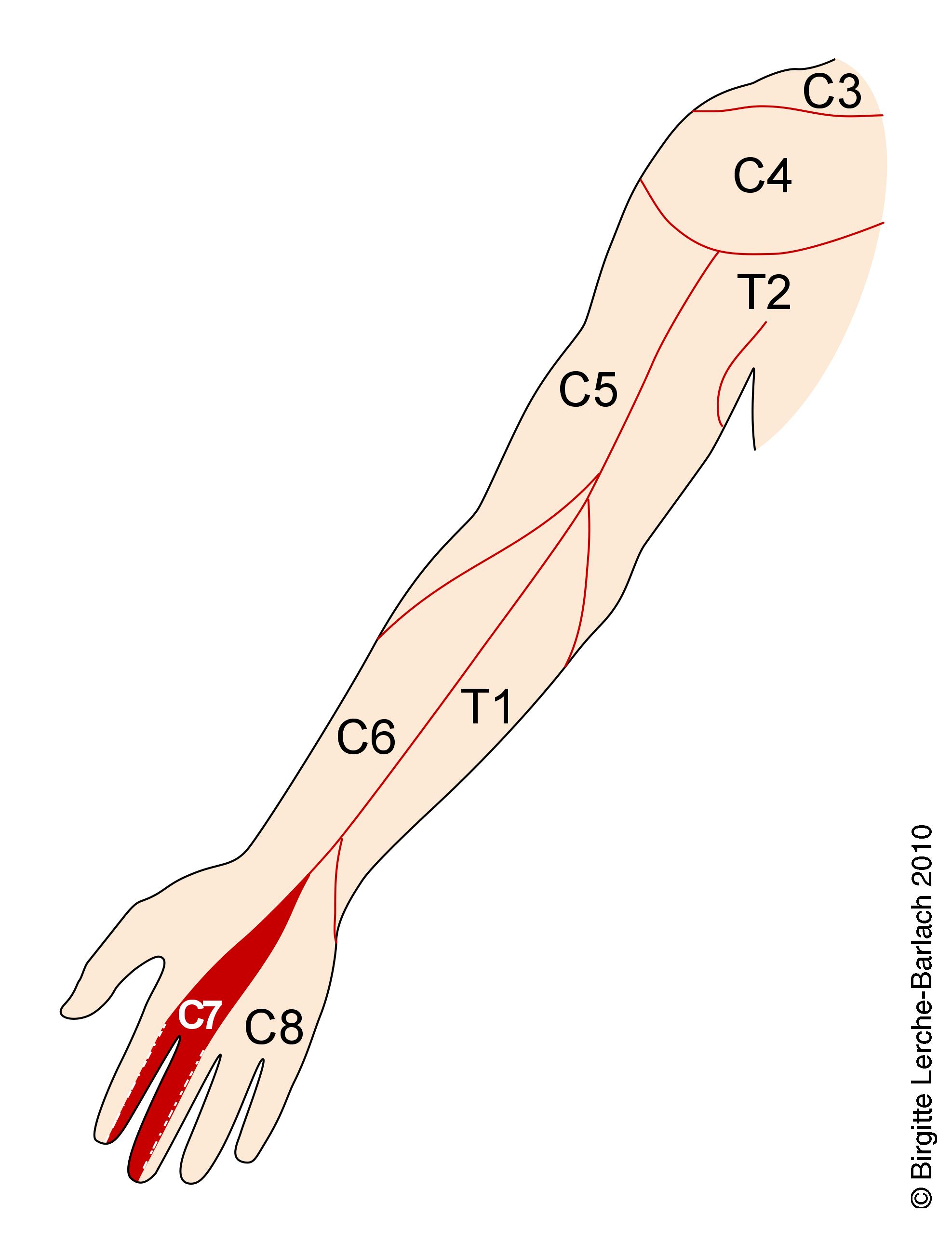 C C C Dermatomes My Xxx Hot Girl