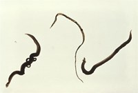 Sneglefeber Schistosomiasis Patienthandbogen Pa Sundhed Dk